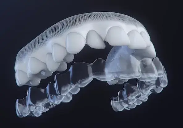 Invisalign_Step02